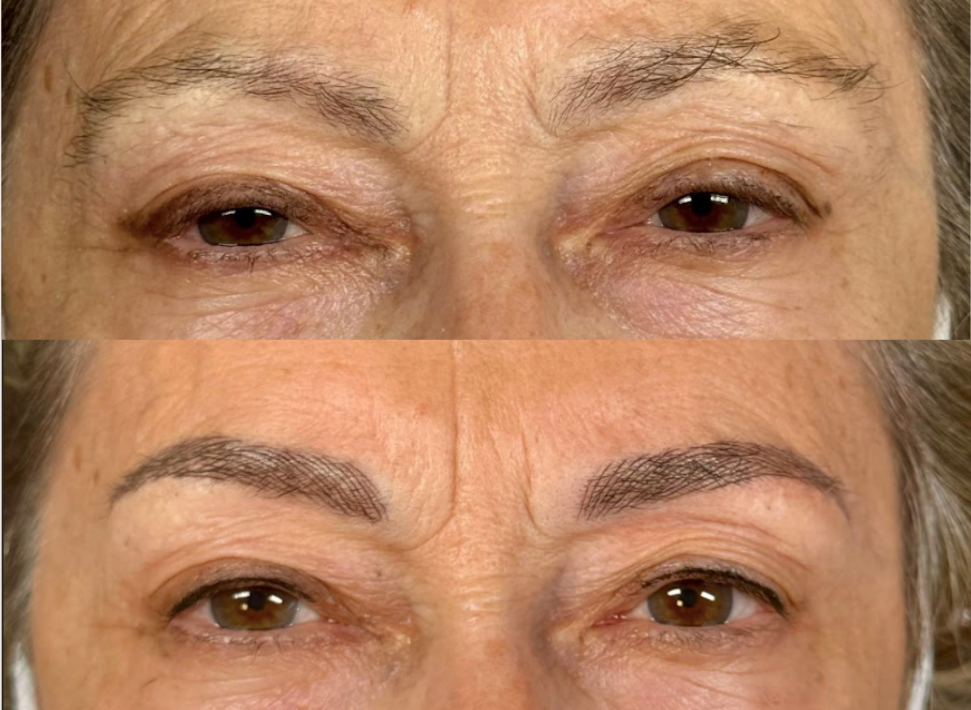 FOTO MICROBLADING NUEVA 4