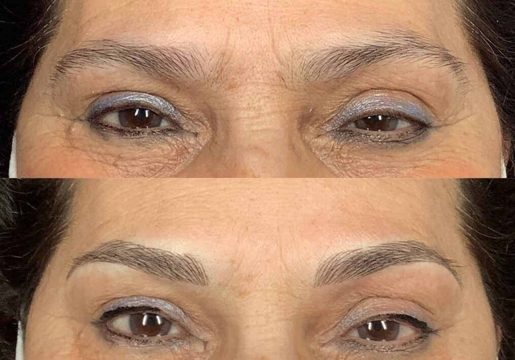 FOTO PARA AÑDIR A MICROBLADING