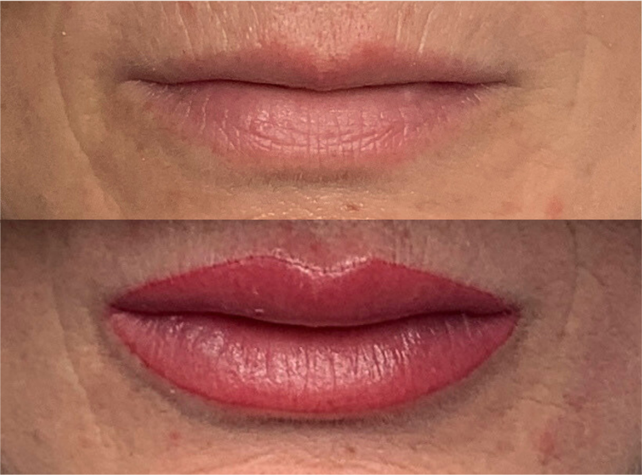 Antes y después labios acuarela