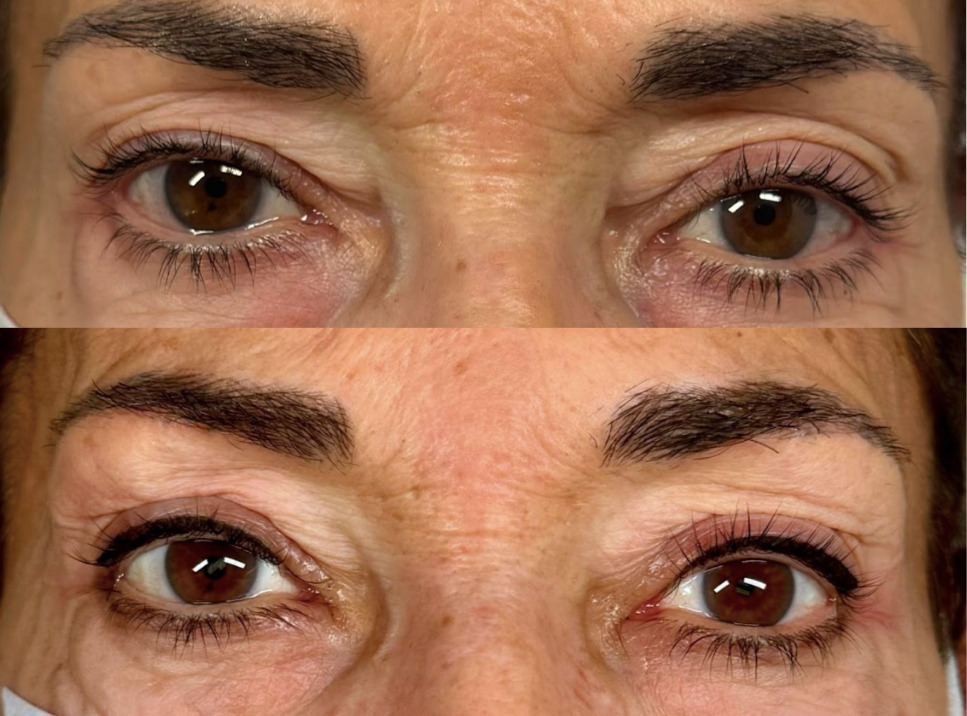 Foto microblading igualada